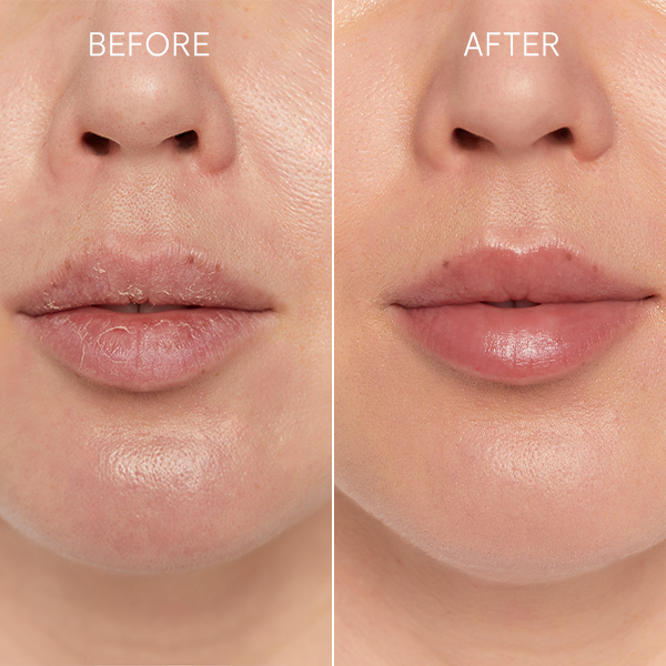 glov-scrubex-exfoliador-labial-de-silicona-reutilizable-para-exfoliaci-n-y-cuida image 2