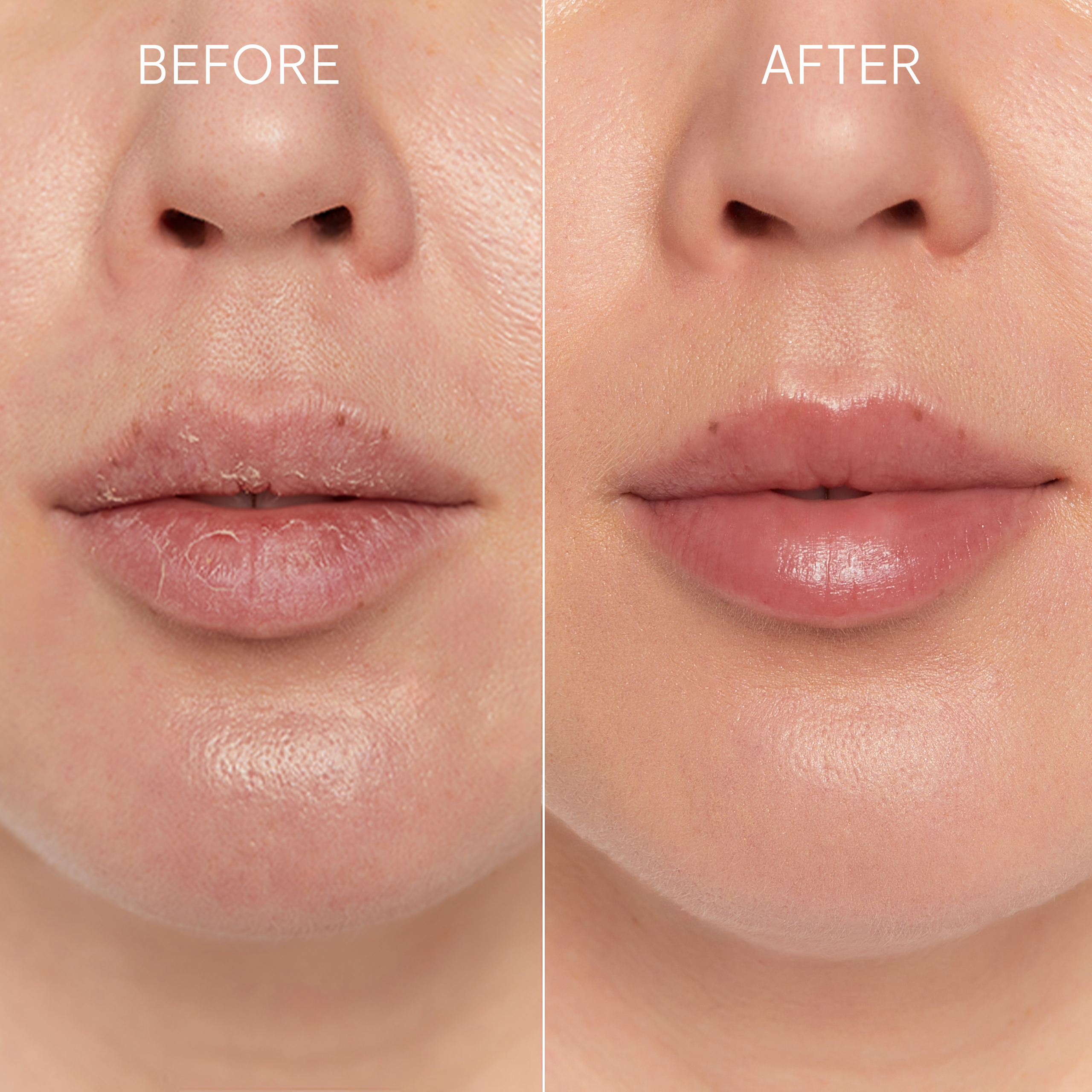 glov-kiss-kiss-set-guante-exfoliante-labial-scrubex-de-bamb-y-b-lsamo-para-labio image 3
